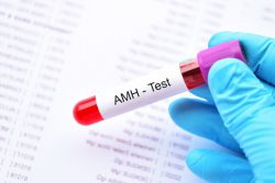 Xét nghiệm chỉ số AMH là gì?