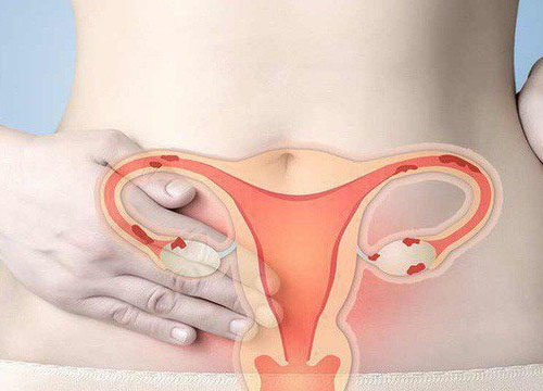 Niêm mạc tử cung mỏng sau phá thai cần làm gì? 