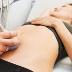 Dấu hiệu dính buồng tử cung sau hút thai