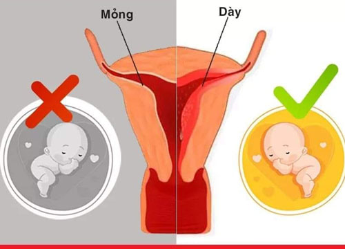 Niêm mạc tử cung mỏng sau hút thai có nguy hiểm?